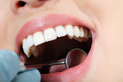 Can Stress Cause Your Teeth to Fall Out?